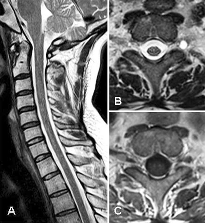 Fig. 1