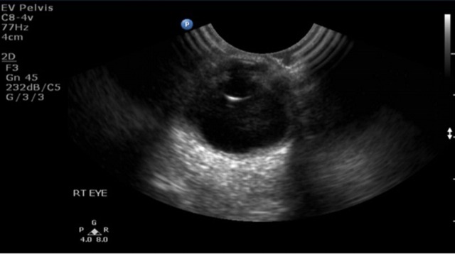 Figure 3