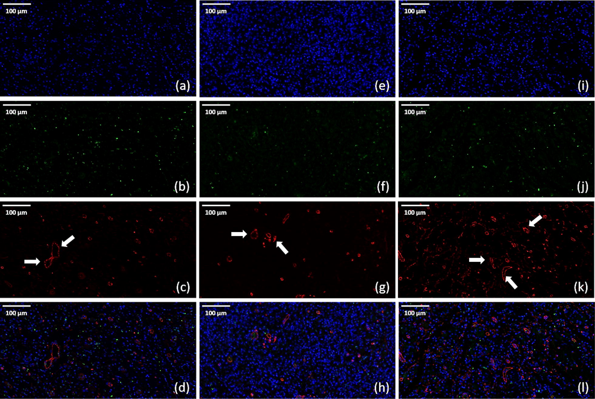 Fig. 14