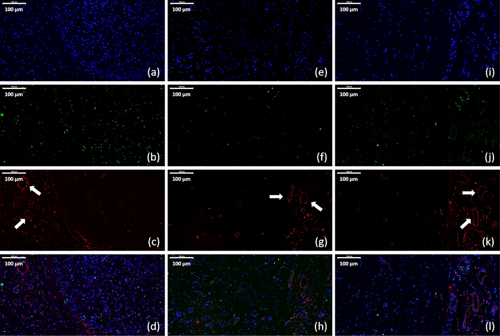 Fig. 13