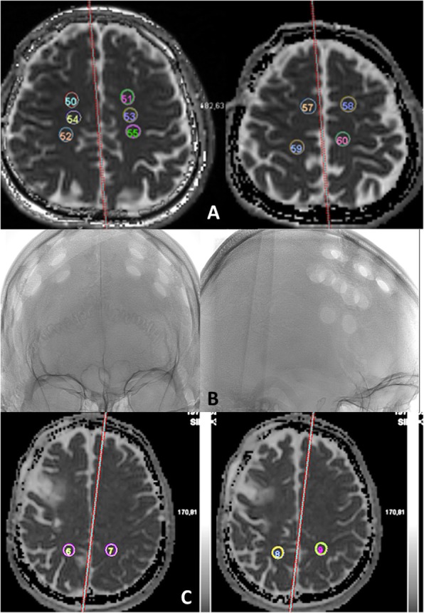 Fig. 1