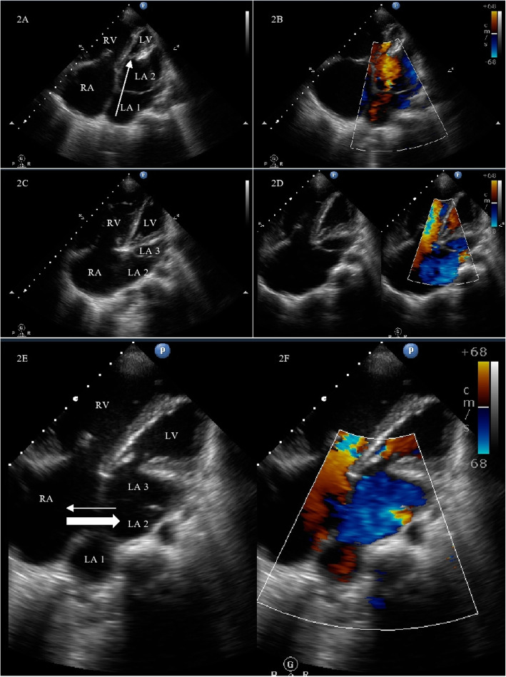 Fig. 2