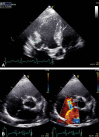 Fig. 4