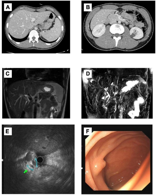 FIGURE 1