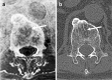 Fig. 11