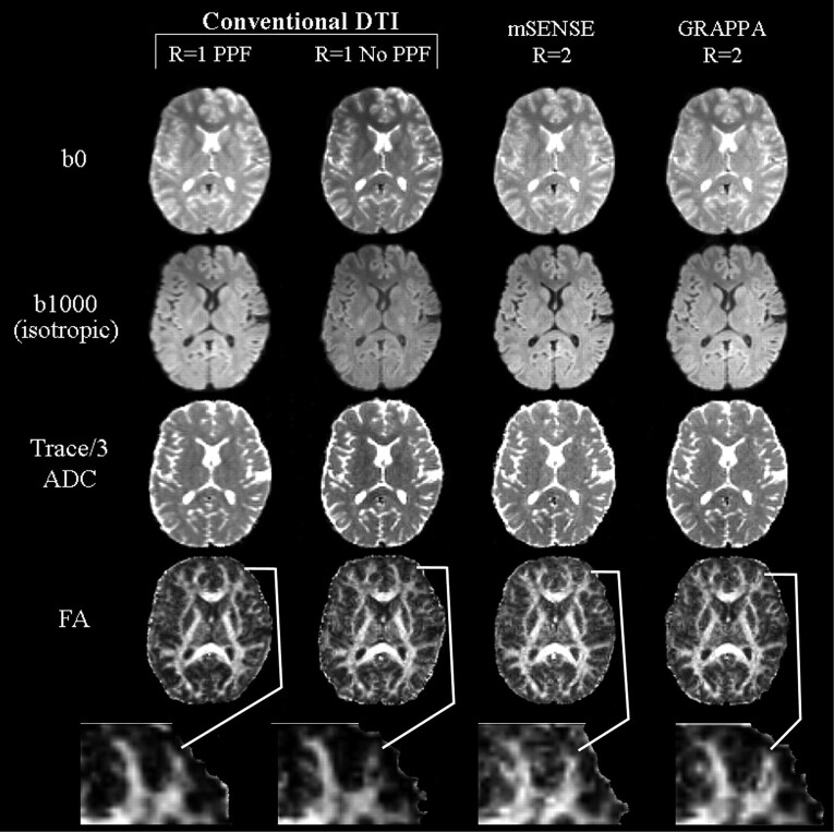 Fig 2.