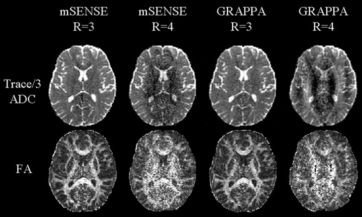 Fig 3.