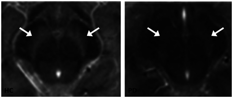 FIGURE 4.