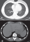 Figure 4)