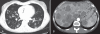 Figure 2)