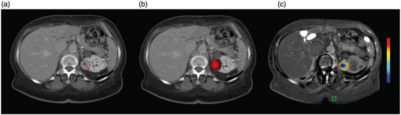 Fig. 2.