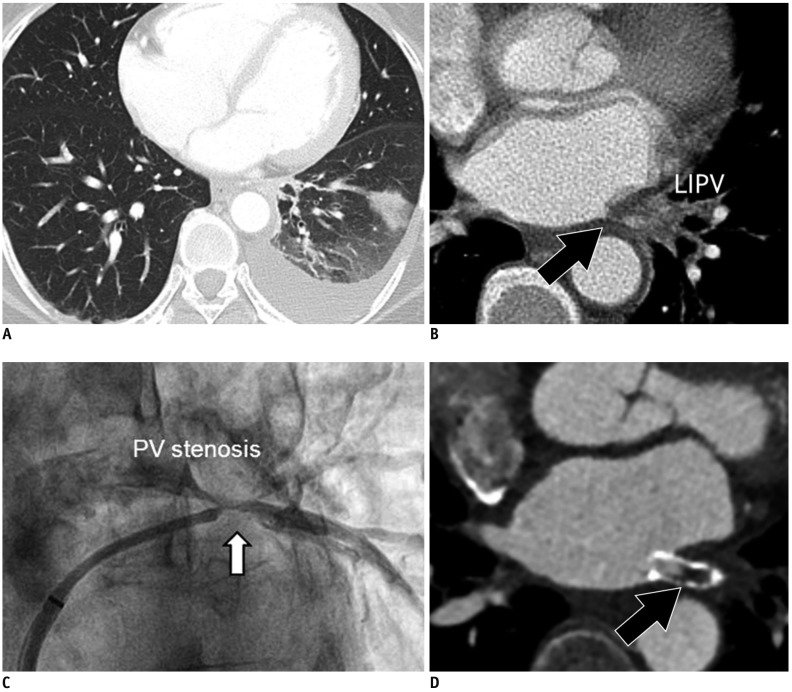 Fig. 11