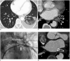 Fig. 11