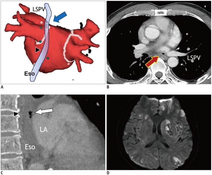 Fig. 12