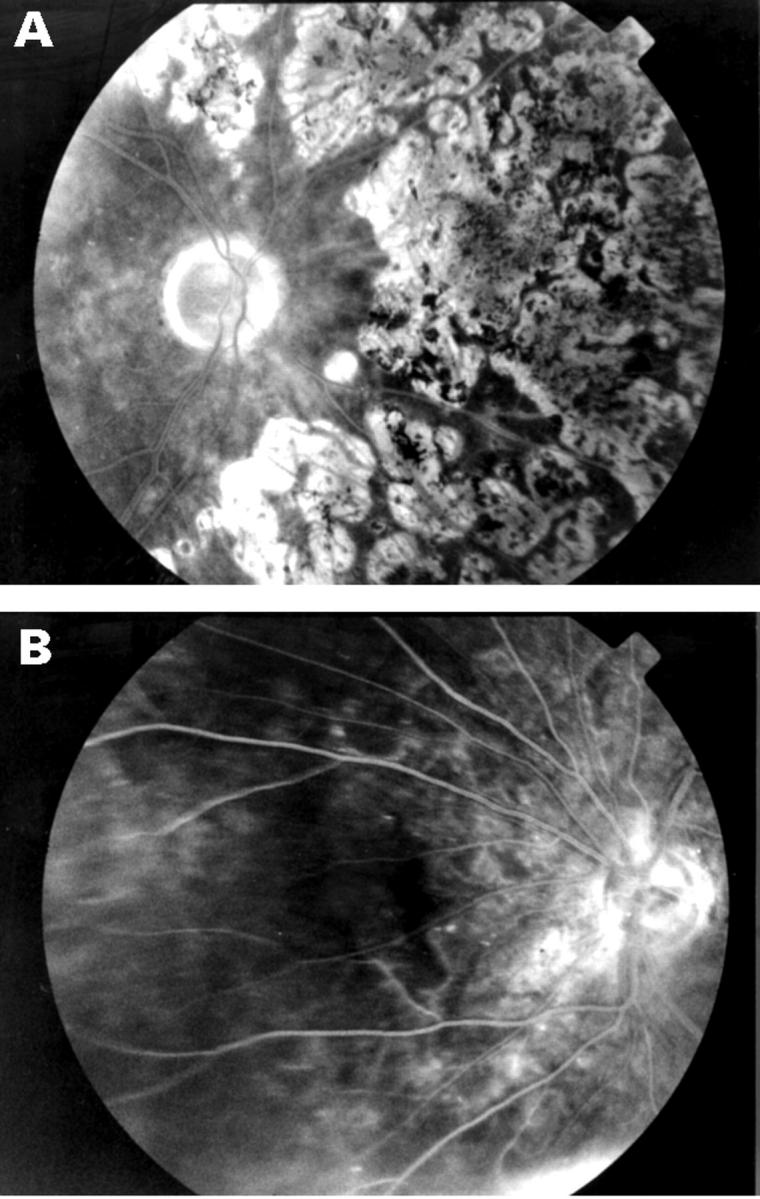 Figure 2  