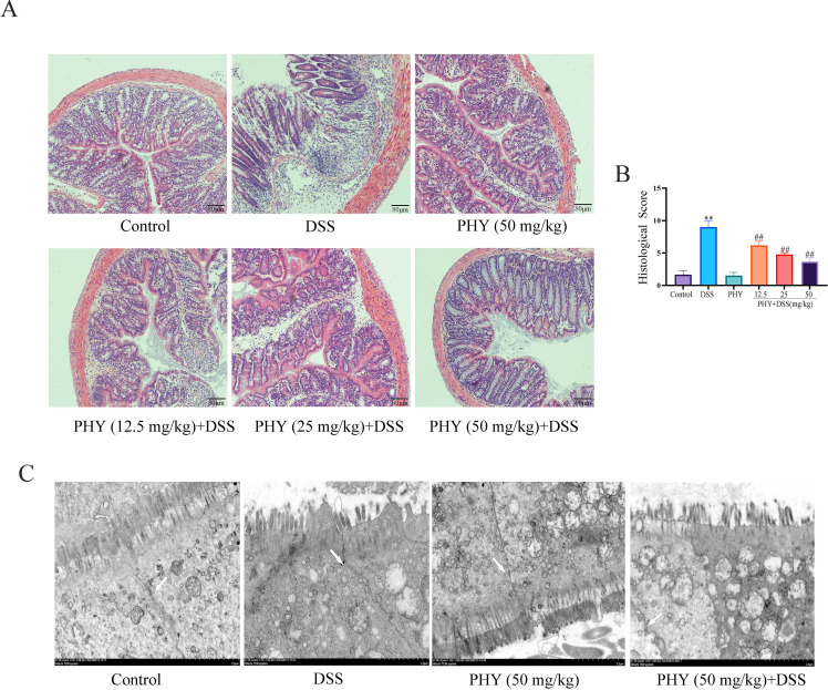 Histological evaluation of PHY effects on DSS-induced colitis: H&E staining depicts intestinal architecture preservation with PHY treatment, reduced histological scores, and electron micrographs indicate improved cellular integrity with PHY intervention.