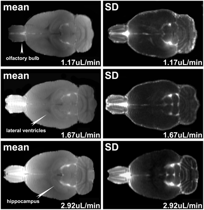 MRI Investigation Of Glymphatic Responses To GdDTPA Infusion Rates PMC