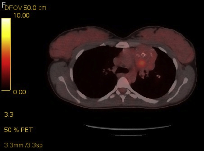 Fig. 3