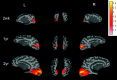 Fig 3.