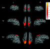 Fig 2.