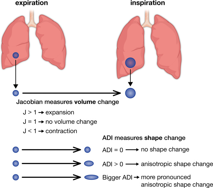 Visual representation of Jacobian (J) and anisotropic deformation index (ADI) values. A Jacobian greater than 1 implies expansion of a voxel between inspiration and expiration, a Jacobian of 1 implies no volume change, and a Jacobian of less than 1 implies voxel contraction. An ADI of 0 implies that a voxel completely preserves its shape between inspiration and expiration, while an increasing ADI implies more anisotropic expansion.