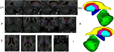 Fig. 3