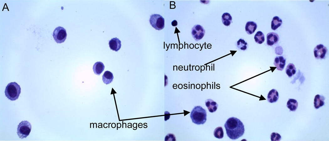 Bronchoalveolar Lavage and Lung Tissue Digestion - PMC