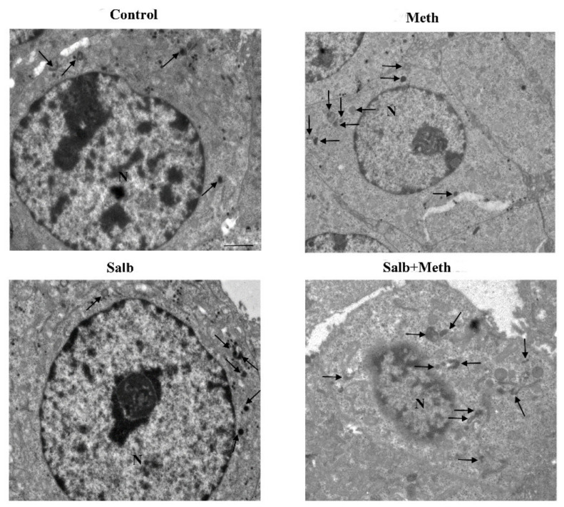 Figure 17