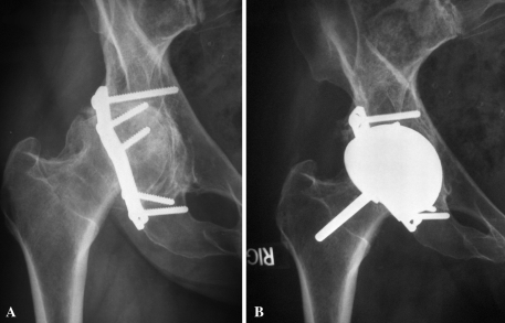 Fig. 1A–B