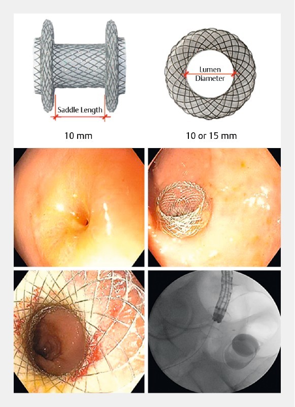 Fig. 1