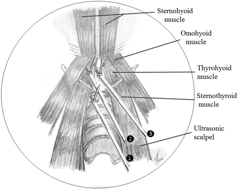 Fig. 2