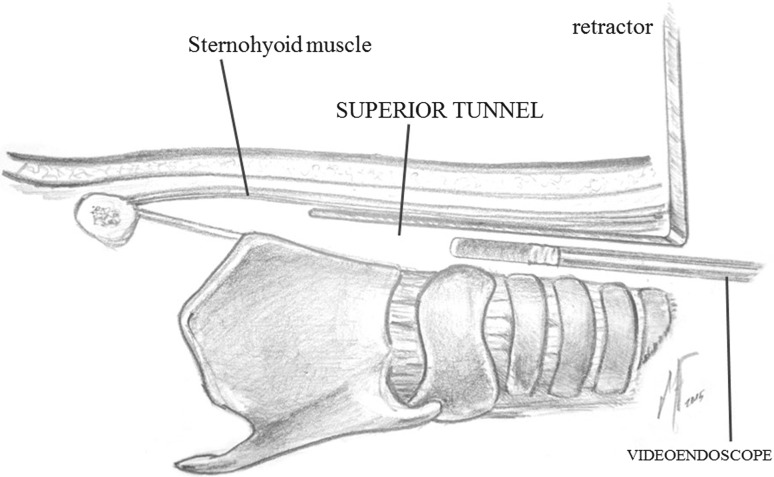 Fig. 1