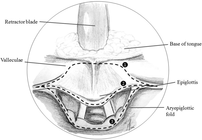 Fig. 5