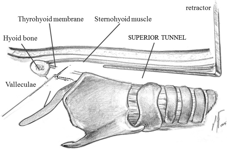 Fig. 6