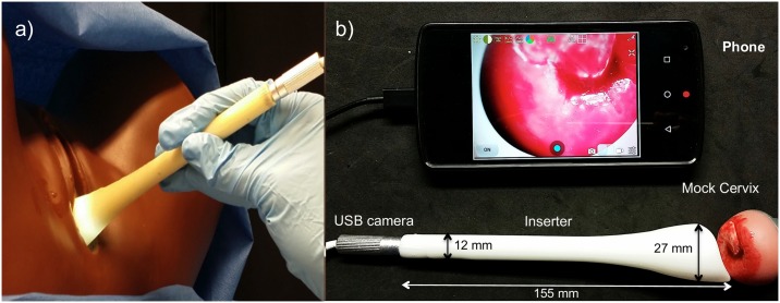 Fig 1