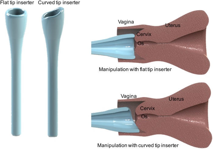 Fig 4