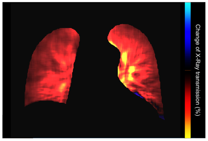 Figure 12