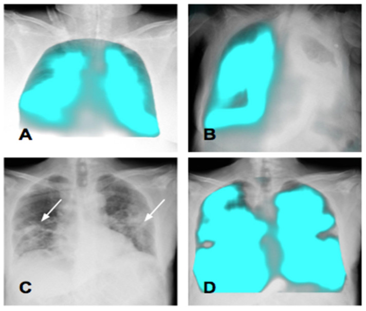Figure 11