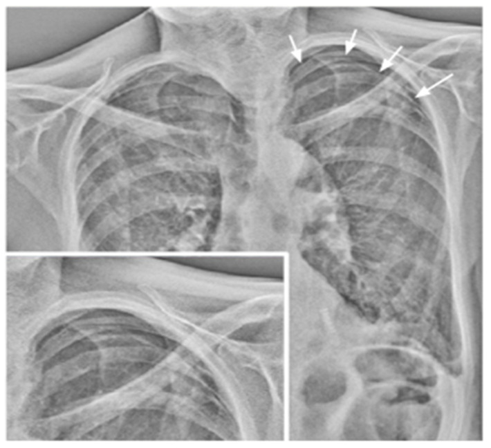 Figure 13