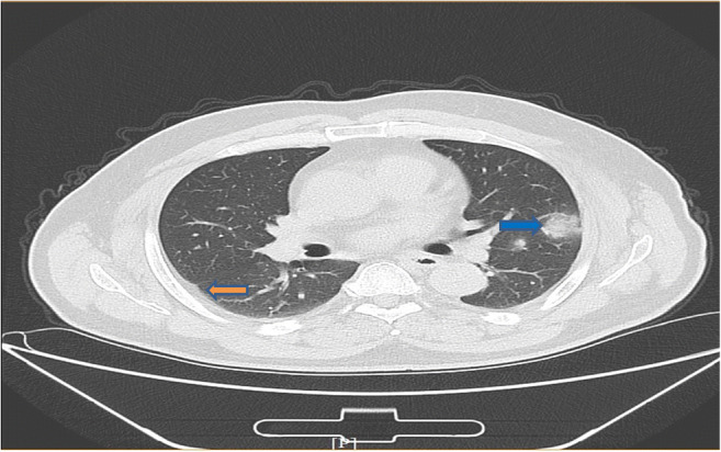 Fig. 2