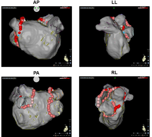 FIGURE 3