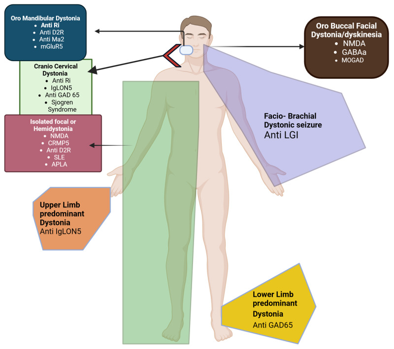 Pattern recognition of dystonia in autoimmune diseases