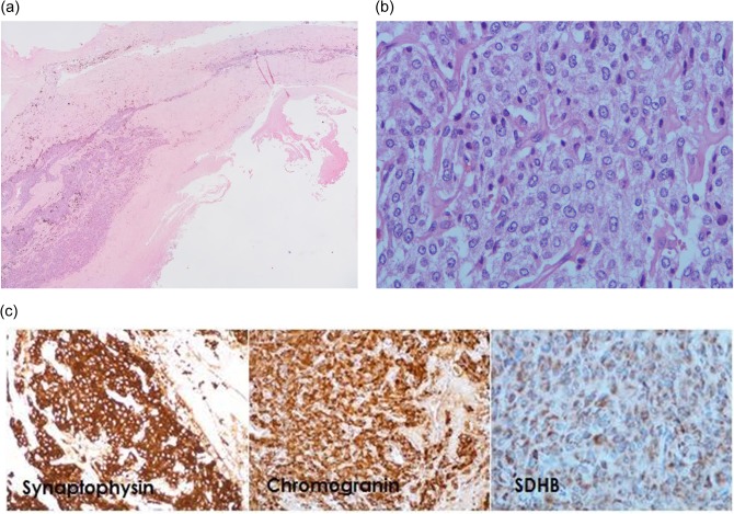 Figure 3: