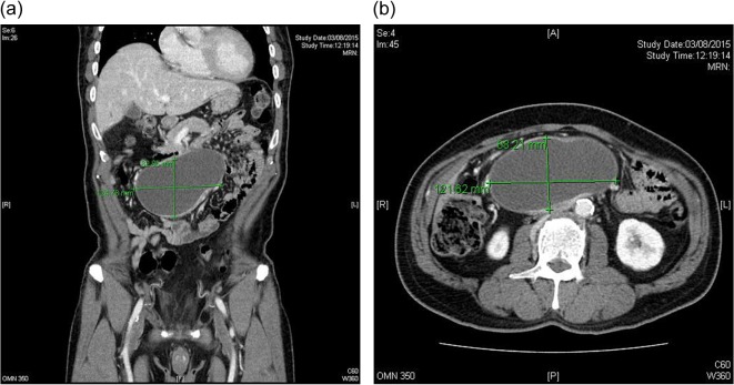 Figure 2: