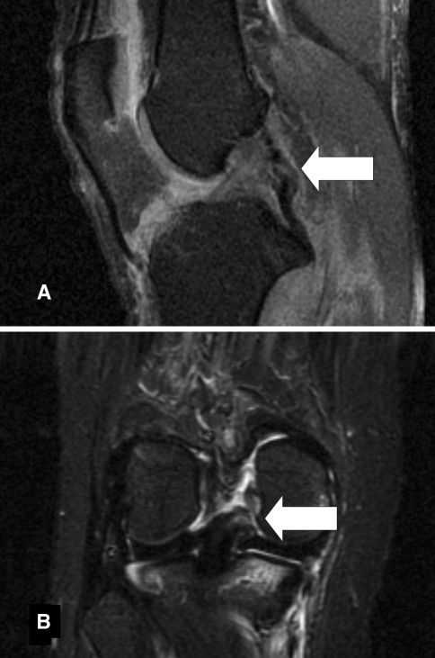 Fig. 7A–B