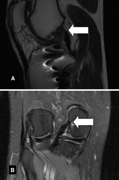 Fig. 8A–B