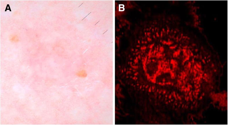 Fig. 4