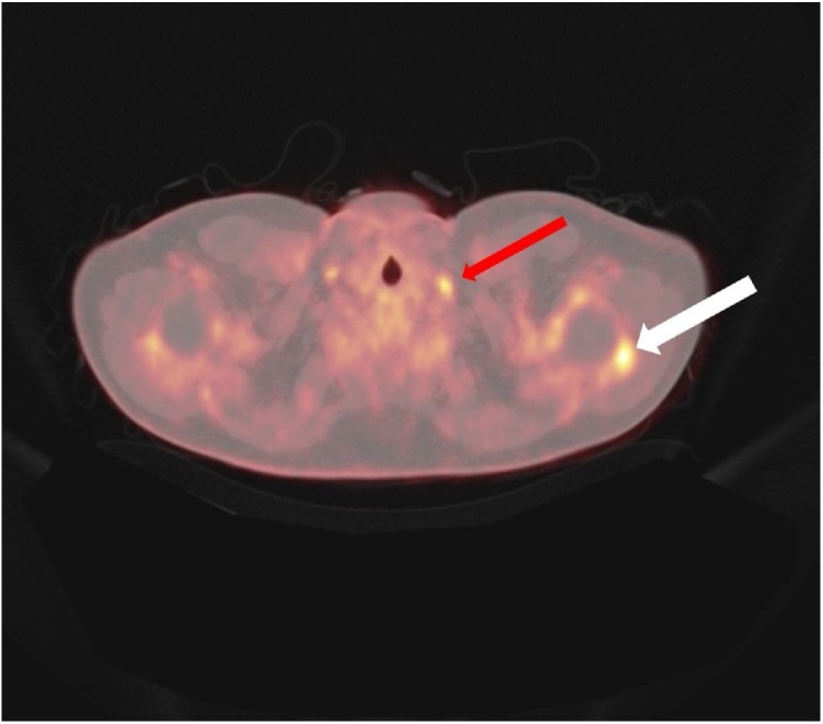 Fig. 2