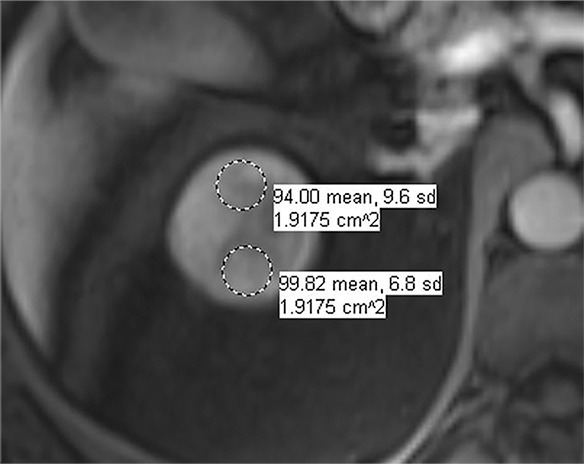 Figure 5h: