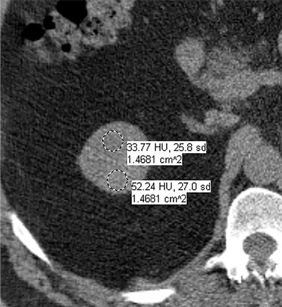 Figure 5a: